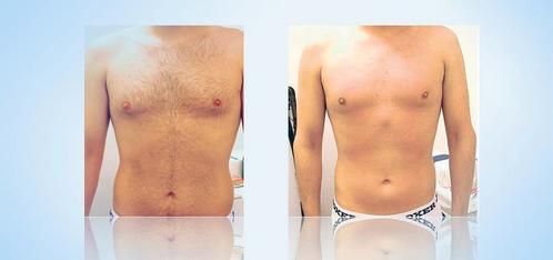 Épilation à la cire et massages pour hommes, Diensten en Vakmensen, Welzijn | Masseurs en Massagesalons, Ontspanningsmassage, Sportmassage