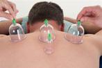 Hijama of cupping