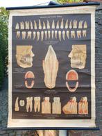Schoolkaart tanden, Antiek en Kunst, Antiek | Schoolplaten, Ophalen