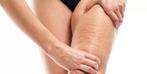 Anti-cellulite massage aan huis, Diensten en Vakmensen