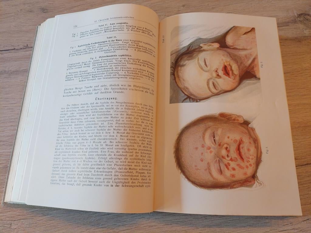 Médecine pédiatrique. Orchestre VIII Rietschel, Dr. Hans 192, Enlèvement ou Envoi