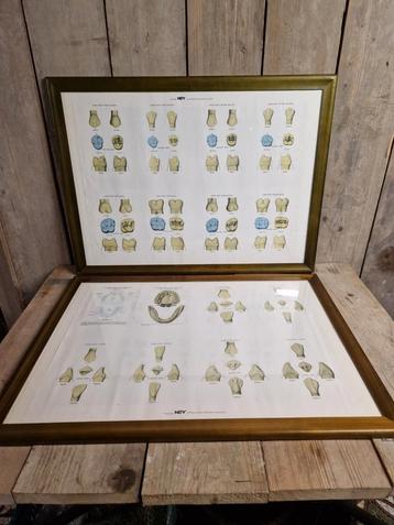 2 vintage medische kaders "het gebit" beschikbaar voor biedingen
