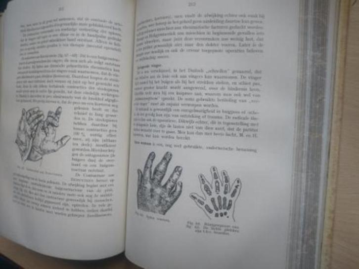 boek: grondbeginselen der orthopaedie ; dr. A.C. Belmonte, Antiek en Kunst, Antiek | Boeken en Manuscripten, Ophalen of Verzenden