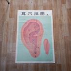 Affiches / posters acupuncture oreille (76 x 52 cm), Ophalen, Deurposter of groter, Overige onderwerpen, Rechthoekig Staand