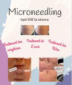 Microneedling, Ophalen of Verzenden