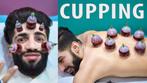 Cupping / Hijama -, Comme neuf