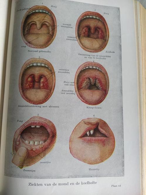 boek: de vrouw als huisdokter/dr. Med. Anna Fischer, Boeken, Gezondheid, Dieet en Voeding, Ophalen of Verzenden