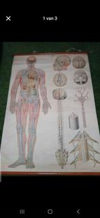 Retro schoolkaart, Enlèvement