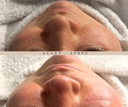 Soin visage, épilation laser, rehaussement de cils…, Bijoux, Sacs & Beauté, Beauté | Soins du visage, Comme neuf, Soins, Enlèvement