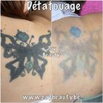 Détatouage au laser tattoo maquillage permanent Microblading, Zo goed als nieuw