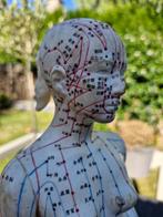 acupunctuur pop, Ophalen of Verzenden
