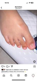 Nagels, Ophalen