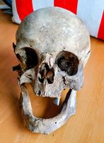 Schedel mens, Ophalen of Verzenden