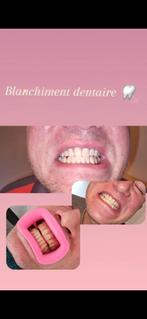 Blanchiment dentaire, Bijoux, Sacs & Beauté, Beauté | Soins de la bouche, Enlèvement ou Envoi, Neuf, Autres types
