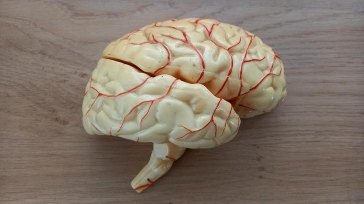 Anatomisch model Rechter Hersenhelft in drie delen, Antiek en Kunst, Curiosa en Brocante, Ophalen of Verzenden