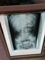 retro negatoscope uit dokterspraktijk, Ophalen of Verzenden