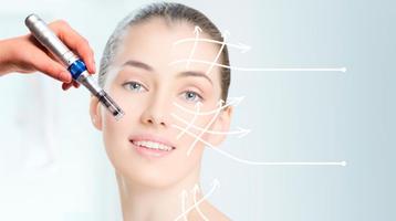 Huidverbetering met Microneedling/ Mesotherapie  beschikbaar voor biedingen
