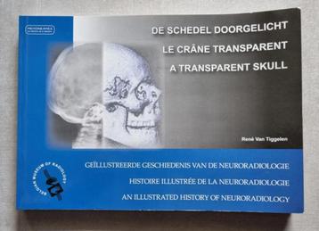Het transparante schedelboek