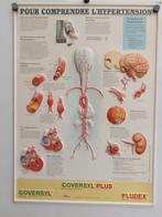 Affiche plastifiée sur l'hypertension artérielle, Verzamelen, Posters, Ophalen, Gebruikt