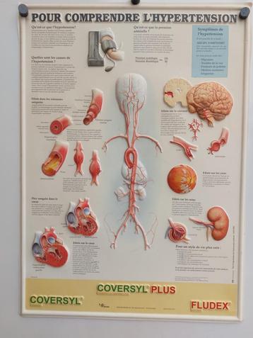 Affiche plastifiée sur l'hypertension artérielle beschikbaar voor biedingen