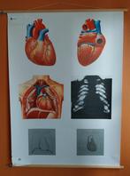 Plaque cardiaque médicale, Antiquités & Art, Enlèvement ou Envoi, Nature et Biologie