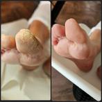 Ambulant Pedicure, regio Beveren-Waas en omstreken, Ophalen of Verzenden