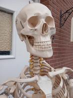 squelette medical, Divers, Enlèvement