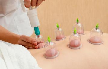 Hijama beschikbaar voor biedingen