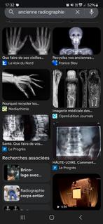 Recherche anciennes radiographies, Enlèvement, Utilisé