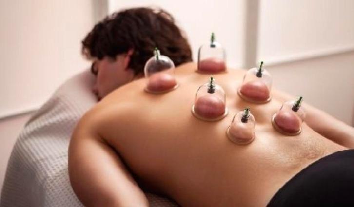 Ventousothérapie (Hijama), Diensten en Vakmensen, Welzijn | Masseurs en Massagesalons
