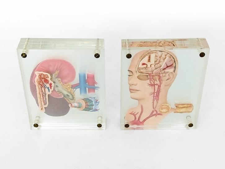 anatomie object plexiglas, Antiek en Kunst, Curiosa en Brocante, Ophalen of Verzenden