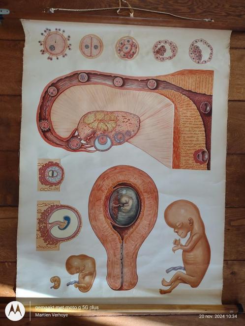 Schoolplaat  "Embryo", Antiek en Kunst, Antiek | Schoolplaten, Natuur en Biologie, Ophalen