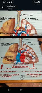 Schoolkaart over de longen, Enlèvement