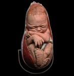 Anatomisch medisch model foetus in vruchtwaterzak gips, Ophalen of Verzenden