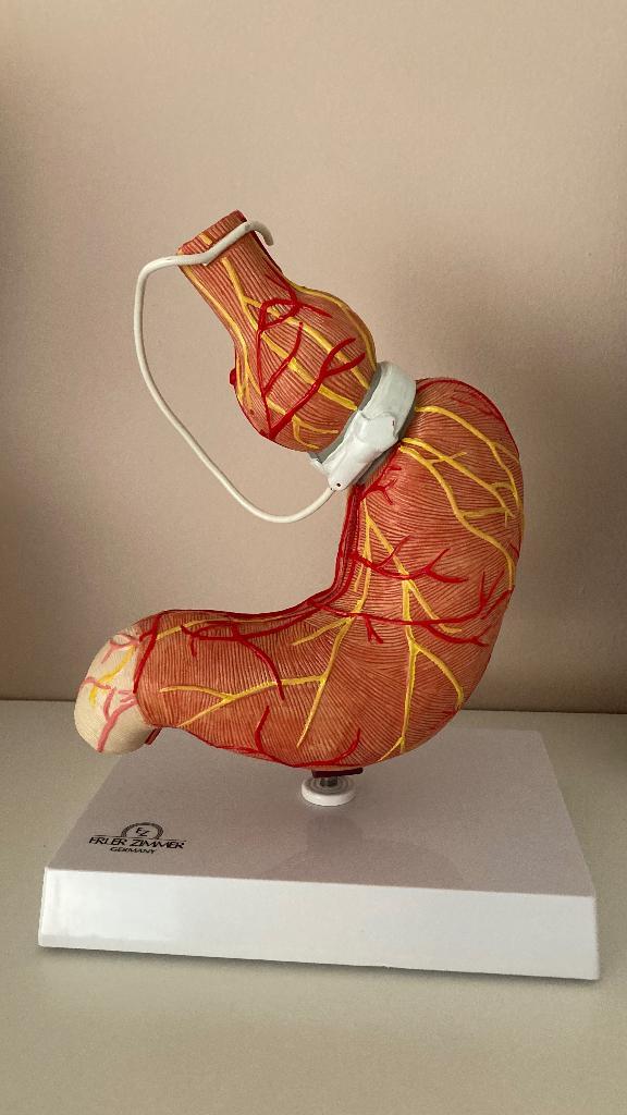 Anatomisch model maag met maagband. Merk:  Erler Zimmer, Diversen, Overige Diversen, Zo goed als nieuw, Ophalen of Verzenden