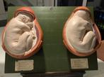 Anatomie foetus  jaren 50/60, Antiek en Kunst, Kunst | Beelden en Houtsnijwerken, Ophalen