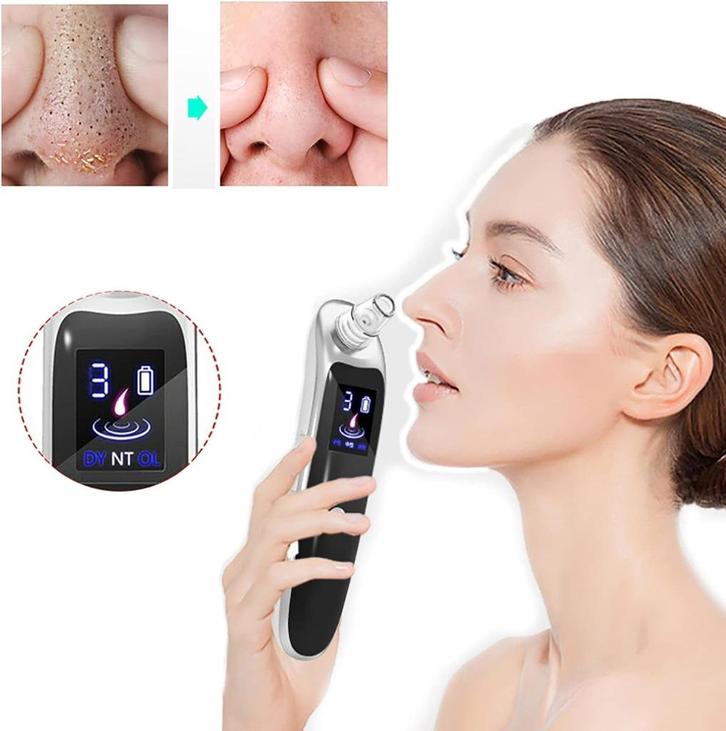 Aspirateur électrique pour points noirs, Handtassen en Accessoires, Uiterlijk | Gezichtsverzorging, Nieuw, Reiniging, Gehele gezicht