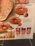 Diverse 80er jaren Anatomie platen uit Dokters Praktijk, Antiek en Kunst, Curiosa en Brocante, Ophalen of Verzenden