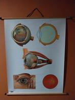 Ancienne plaque/affiche médicale, au-dessus de l'œil, Collections, Collections Autre, Enlèvement ou Envoi