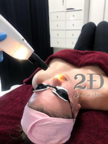 !! Promo!! Carbone Peeling gezichtsverzorging beschikbaar voor biedingen