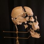 Crâne humain Beauchène, Crâne, Enlèvement ou Envoi