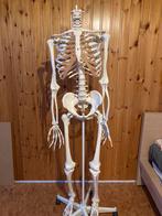 Squelette pour études médicales, Enlèvement