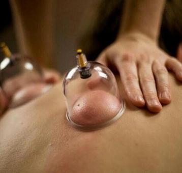 cuppingtherapie beschikbaar voor biedingen