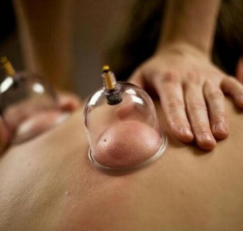 cuppingtherapie, Vacatures, Vacatures | Uiterlijke verzorging